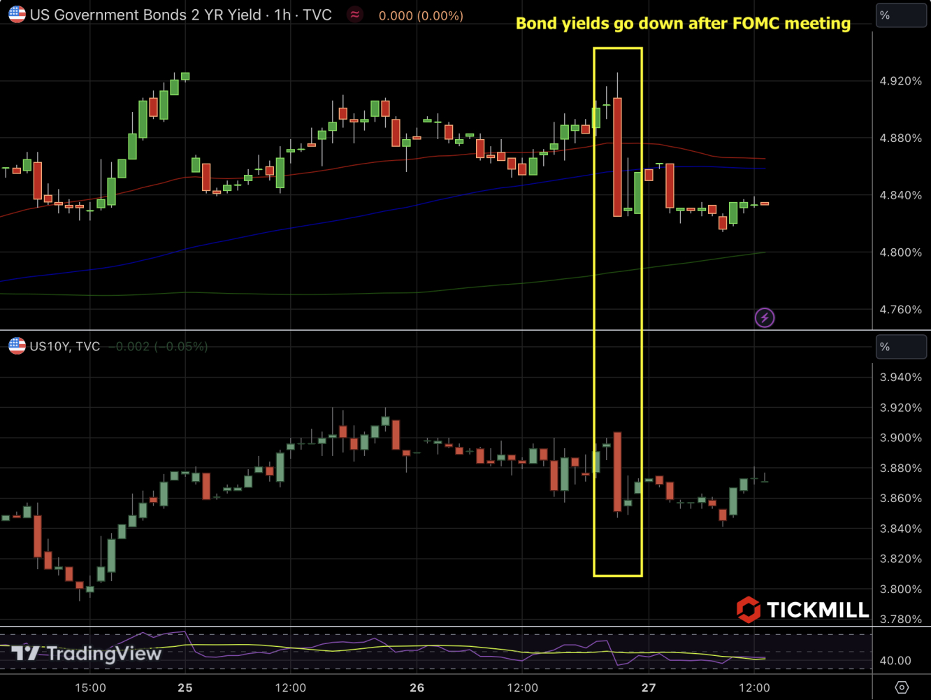 bond yield reaction